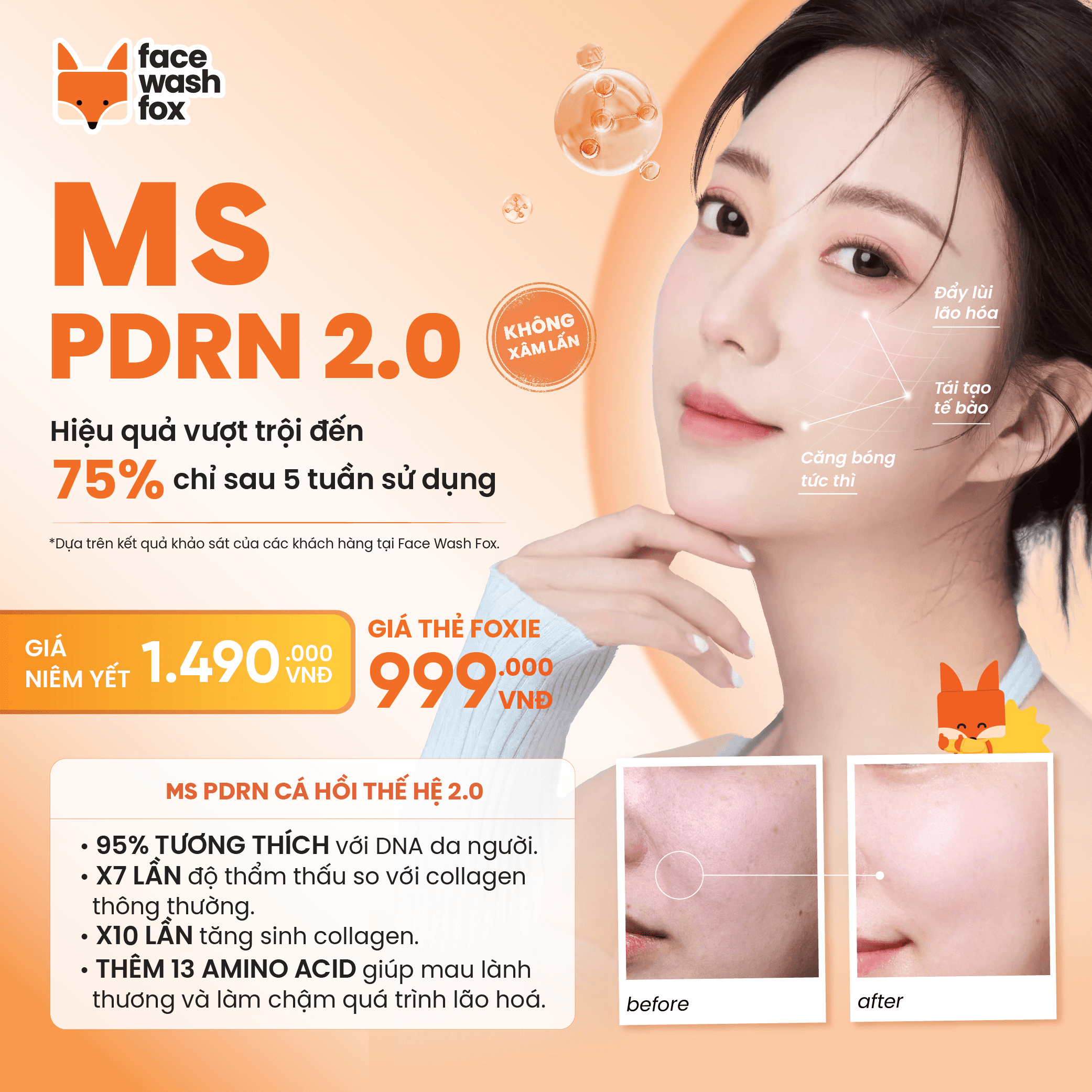 MS PDRN